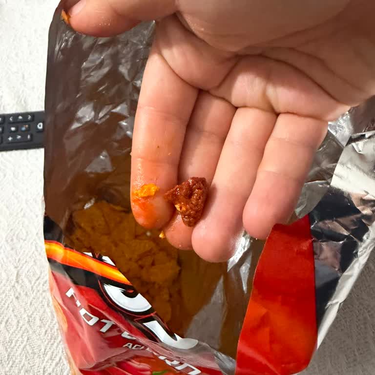 Doritos Cips Paketi İçinde Büyük Taş Çıktı Dişim Kırıldı
