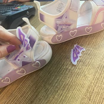 Vicco Sandaletinde Tekrarlayan Kalite Sorunu Ve Hızlı İade Talebi