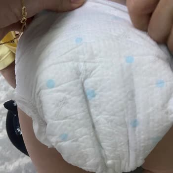 Sert İç Dolgu Nedeniyle Bebekte Kızarıklık Ve Tahriş, İade Talebi