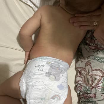 Mustela Şampuan Ve Nemlendiriciden Bebeğimde Alerjik Döküntü, Açıklama Ve Geri Dönüş Talebi