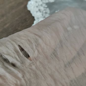 Üçlü Takımda Kumaş Yırtılması Ve Beden Uyumsuzluğu