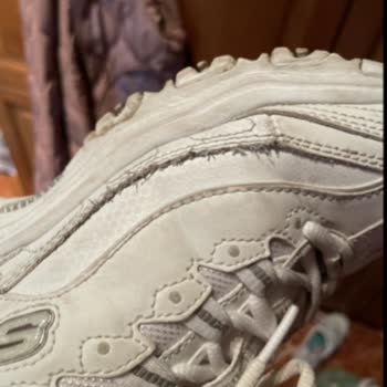 Skechers D’Lites Fresh Start Ayakkabısında 11 Ayda Aşırı Yıpranma