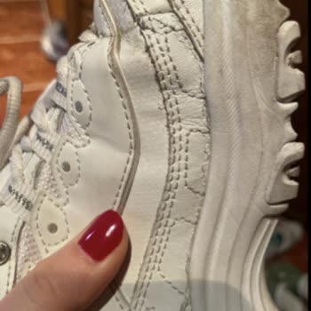 Skechers D’Lites Fresh Start Ayakkabısında 11 Ayda Aşırı Yıpranma