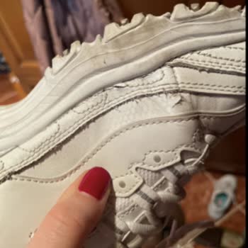 Skechers D’Lites Fresh Start Ayakkabısında 11 Ayda Aşırı Yıpranma