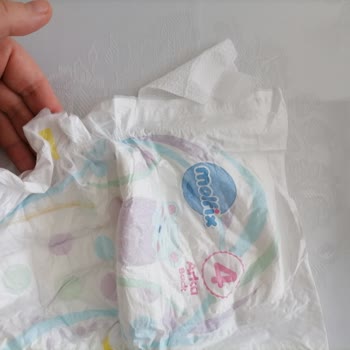 Molfix Bebek Bezinde Görünür Yabancı Cisim: Hijyen Ve Güvenlik Endişesi