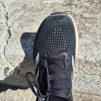 Ayıplı Adidas Süpernova Rise Ayakkabısının İnceleme Sonrası Değişim Talebi