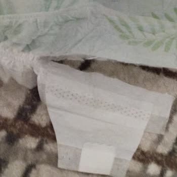 Canbebe Bezi Cırtı Kısmı Kırıldı Ve Telafi Talep Ediliyor
