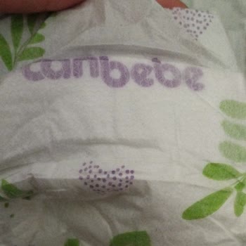 Canbebe Bezi Cırtı Kısmı Kırıldı Ve Telafi Talep Ediliyor