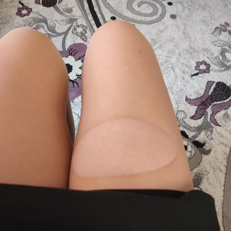 Penti Külotlu Çorapların Tek Kullanımda Yırtılması Ve Kalite Sorunu