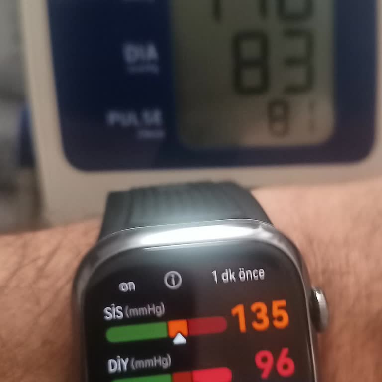 Huawei Watch D2 Tansiyon Ölçümünde Hatalı Sonuçlar Ve Servis Sorunu