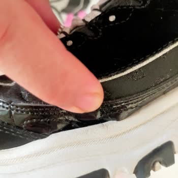 Skechers Ayakkabı Açılma Sorunu Üretim Hatası Olarak Değerlendirilmeli