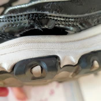 Skechers Ayakkabı Açılma Sorunu Üretim Hatası Olarak Değerlendirilmeli