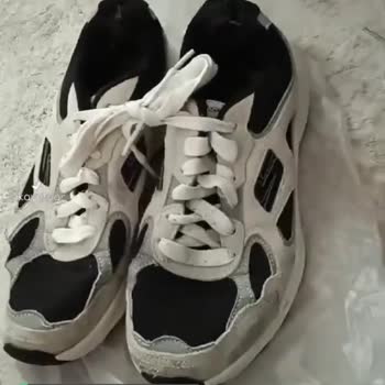 Skechers Ayakkabı Deformasyonu
