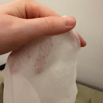 Molfix Islak Mendilde Sert Yabancı Madde Çıktı Çocuk Güvenliği Endişe Yarattı
