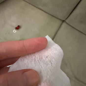 Molfix Islak Mendilde Sert Yabancı Madde Çıktı Çocuk Güvenliği Endişe Yarattı