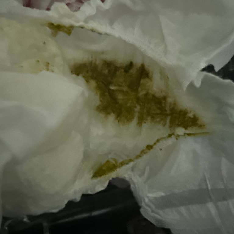 Bebekte Yeşil Kaka Ve Kusma Belirtileri