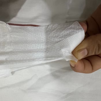 Molfix 5 Numaralı Bezde Cırt Cırt Açma Yeri Sorunlu, Değişim Talebi