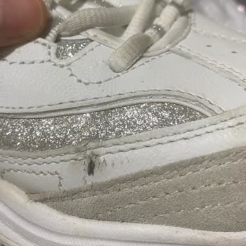 Üst Kısmı Yırtılan 7.700 TL'lik Skechers Ayakkabıda Ayıplı Mal İadesi Talebi