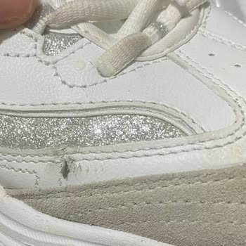 Üst Kısmı Yırtılan 7.700 TL'lik Skechers Ayakkabıda Ayıplı Mal İadesi Talebi