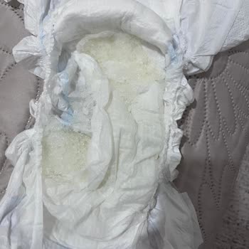 Molfix Bebek Bezlerinde Jel Sızıntısı Cilt Tahrişine Neden Oluyor