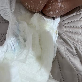Molfix Bebek Bezlerinde Jel Sızıntısı Cilt Tahrişine Neden Oluyor