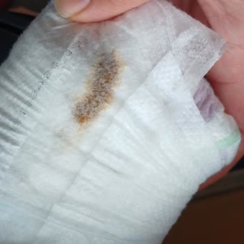 Trendyol'dan Alınan Molfix Bebek Bezlerinde Sızıntı Ve Ücretsiz Değişim Talebi