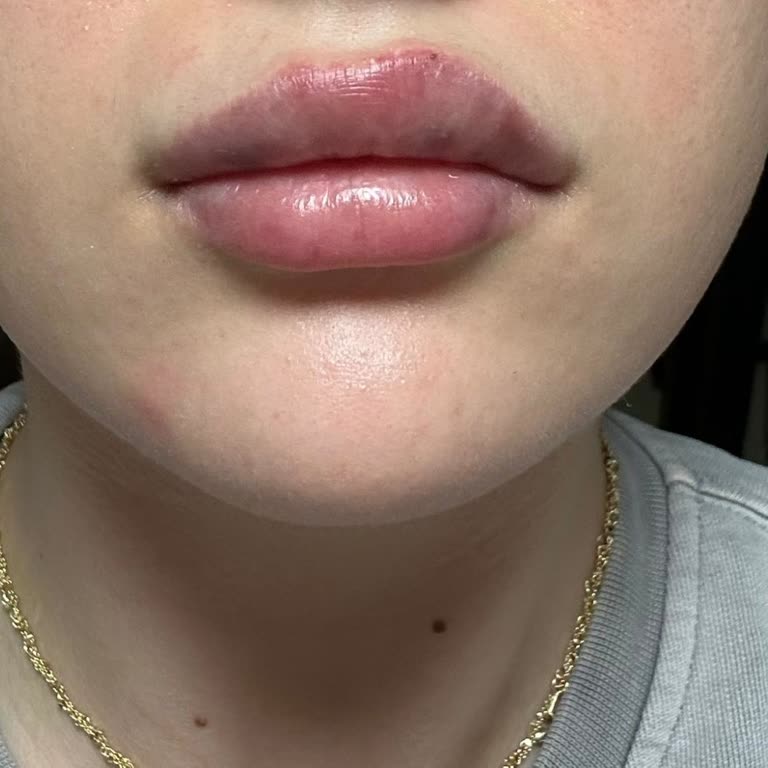 Derma Skins Clinic Şikayeti