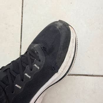 Skechers Ayakkabısında Yan Patlaması Ve Garanti Reddi