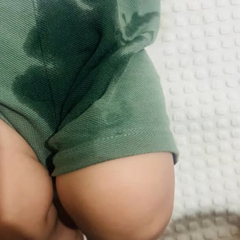Molfix Bebek Bezi Sızdırma Sorunu Ve Cevapsız Şikayet