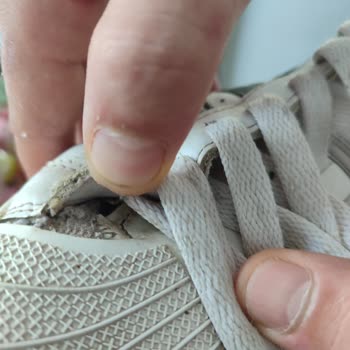 Adidas Superstar Ayakkabısında Hızlı Yırtılma Ve Değişim Reddi