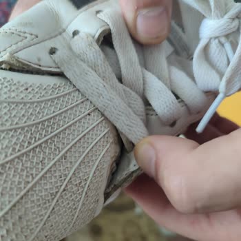 Adidas Superstar Ayakkabısında Hızlı Yırtılma Ve Değişim Reddi