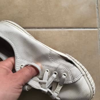 Trendyol’da Ayıplı Sneaker 5 Ayda Yırtıldı, Değişim Talebi