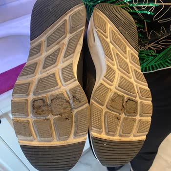 Skechers Ayakkabısında Görülen Deformasyon Ve Çözüm Talebi