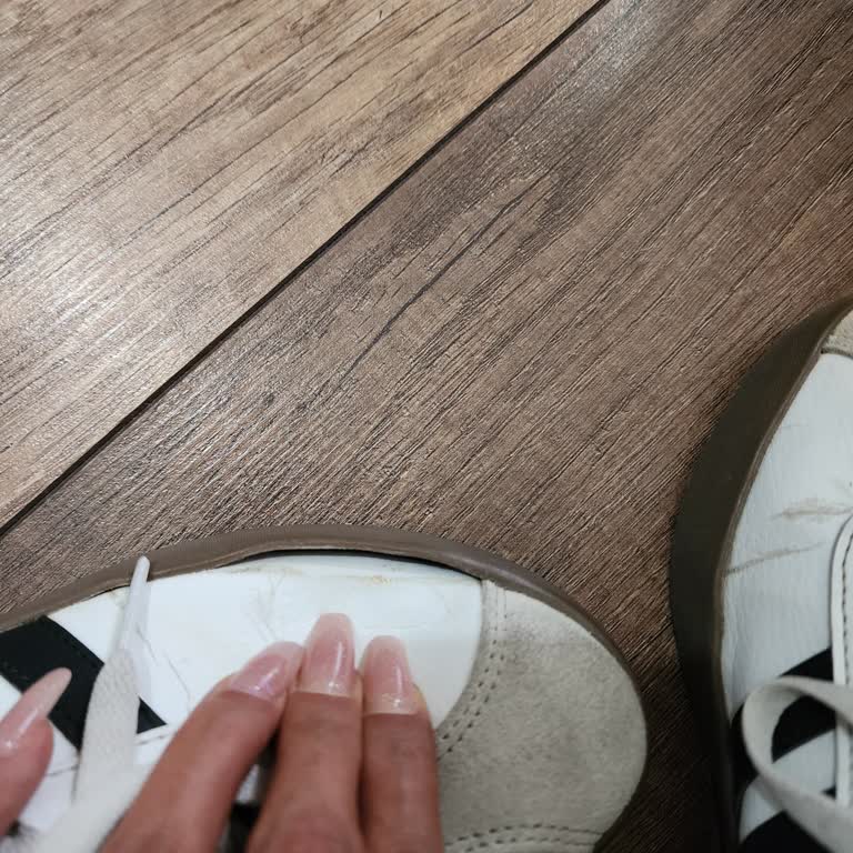 Adidas Ayakkabımda Üst Katman Açılması Ve Satış Sonrası Destek Eksikliği