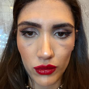 Mehrzad Clinic | @m_technique.poya Hem Maddi Zarara Uğratıldım Hem Fiziksel Olarak Hırpalandım