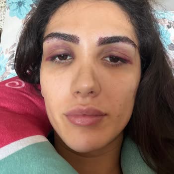 Mehrzad Clinic | @m_technique.poya Hem Maddi Zarara Uğratıldım Hem Fiziksel Olarak Hırpalandım