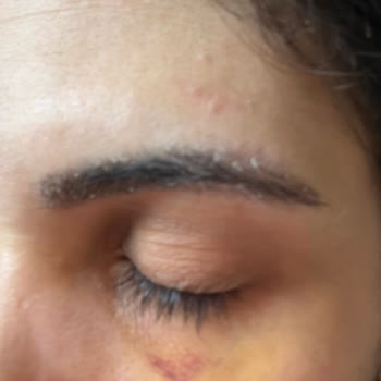 Mehrzad Clinic | @m_technique.poya Hem Maddi Zarara Uğratıldım Hem Fiziksel Olarak Hırpalandım