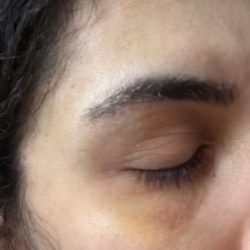 Mehrzad Clinic | @m_technique.poya Hem Maddi Zarara Uğratıldım Hem Fiziksel Olarak Hırpalandım