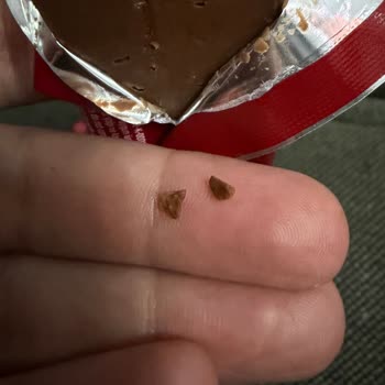Fındık Kabuğu İçeren Çikolata Dişimi Kırdı