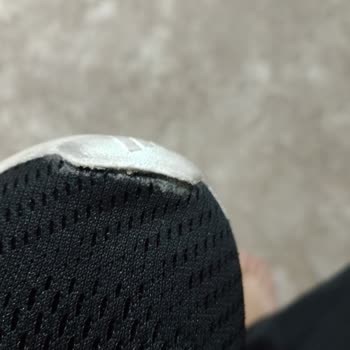 Adidas Ayakkabılarda Ön Yırtılma Ve Kalite Sorunu, İade İstemi