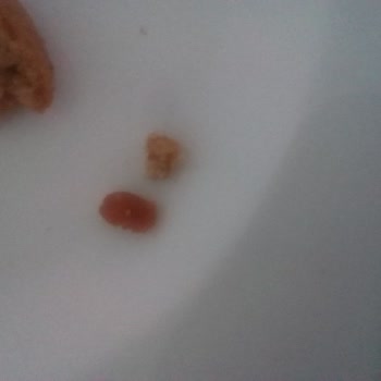Ülker Dankek Lokmalık Ürünün Kalitesinde Sorun Ve Özür Talebi