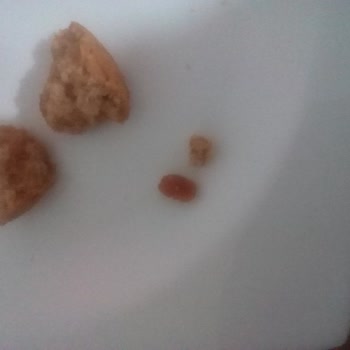 Ülker Dankek Lokmalık Ürünün Kalitesinde Sorun Ve Özür Talebi