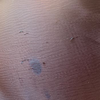İlk Giyişte Göğüs Ve Bacak İplerinin Çıkması Ayıplı Ürün Şikayeti
