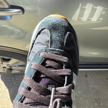 Adidas Ayakkabının Renk Solması Ve İade Talebi Reddedildi