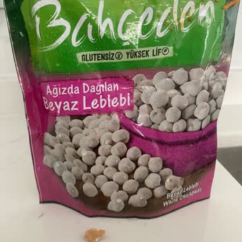 Üründe Taş Parçası Bulunması Diş Sağlığını Tehdit Ediyor