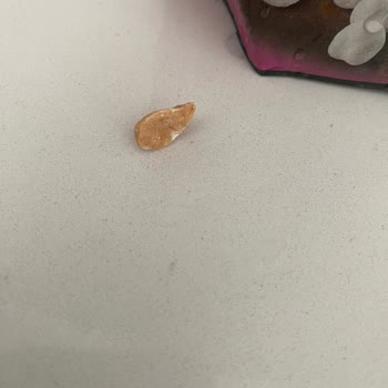 Üründe Taş Parçası Bulunması Diş Sağlığını Tehdit Ediyor