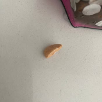 Üründe Taş Parçası Bulunması Diş Sağlığını Tehdit Ediyor