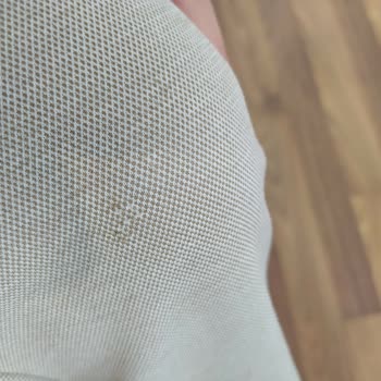 Hızlı Tüylenen Pantolon Ve Mağazanın Çözüm Üretememesi