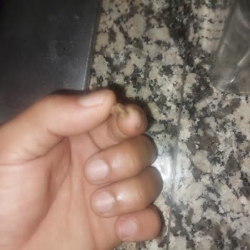 UNO Markalı Dilimli Ekmekte Kemik Parçası Çocuğu Tehlikeye Attı