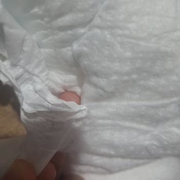 Molfix 5 Numaralı Bebek Bezinde Bantların Pamuk Kısmına Yapışması Ve Parçalanması